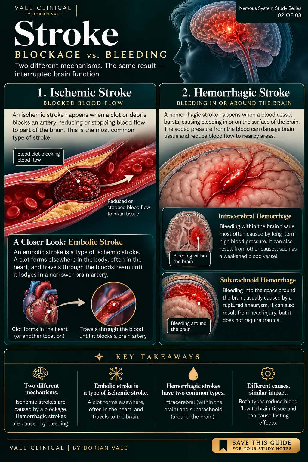 Vale Clinical stroke infographic comparing ischemic blocked blood flow and hemorrhagic bleeding, with embolic stroke shown as an ischemic subtype.